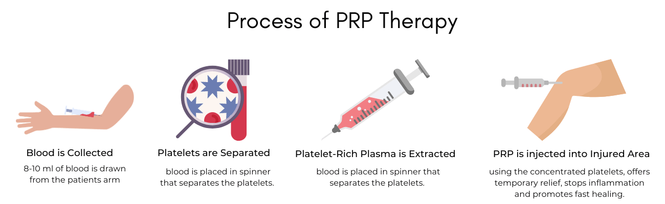Get Back to Life with Platelet-Rich Plasma