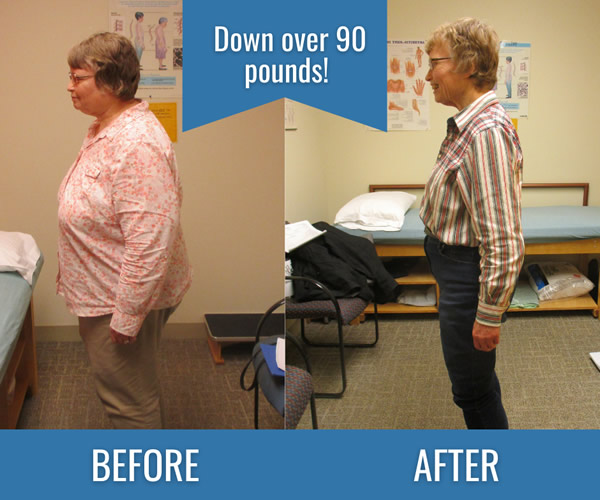 Hip Injury Leads to Weight Loss Transformation