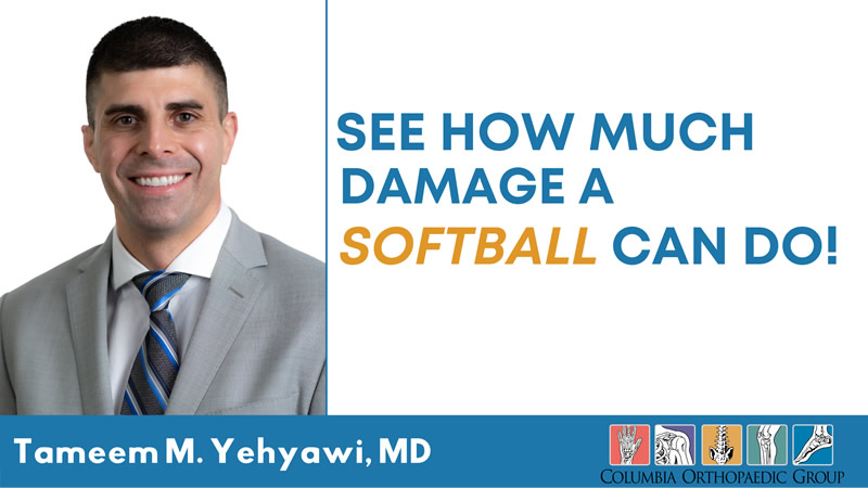 See How Much Damage a Softball Can Do!